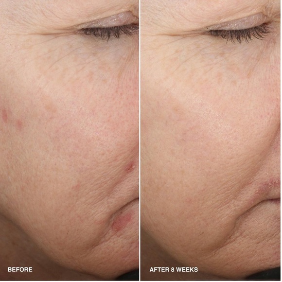 Bobbi Brown Vitamin Enriched Smoothing Serum Brand New in Box Authentic - Picture 6 of 13